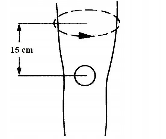 Tynor elastinis kelio įtvaras, neopreninis kelio stabilizatorius, atrama